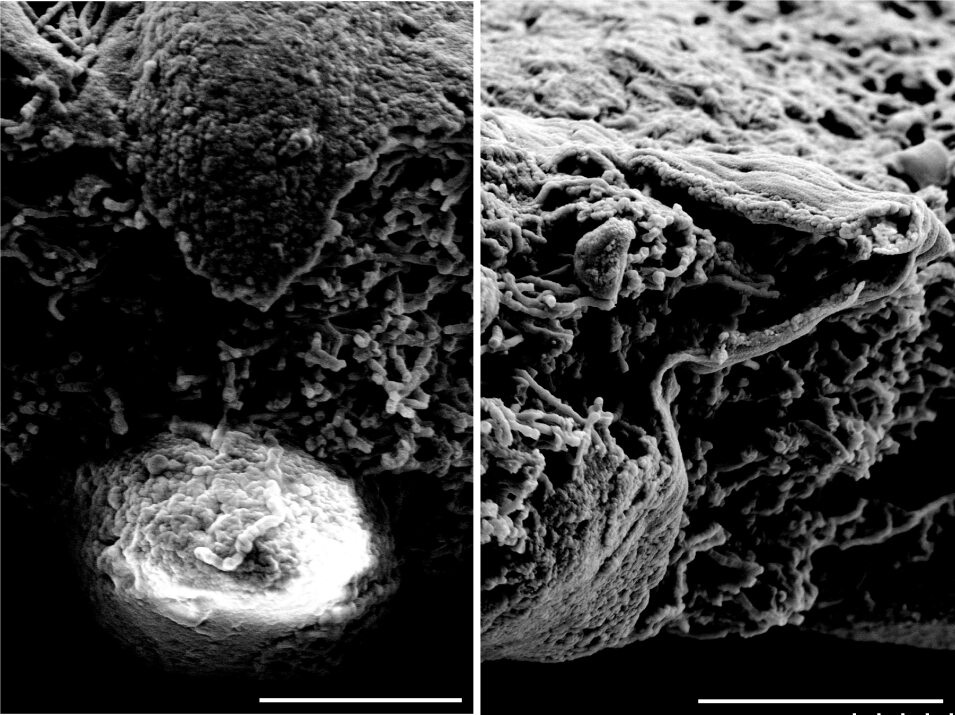 Scanning electron micrograph of endothelial cell - pericyte bilayer.